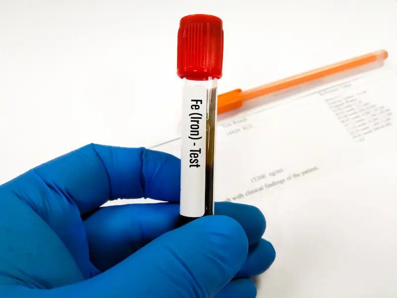 Understanding Iron Blood Tests